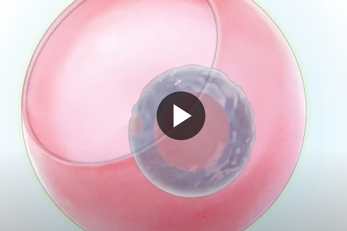 Artist rendering of a hydrogel